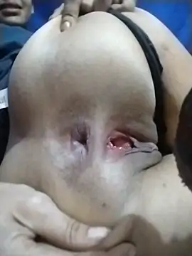 medulili live